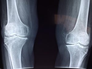 Home Orthopedische zorg in Hoogvliet voor behandeling van blessures en chronische pijn bij alle leeftijdsgroepen